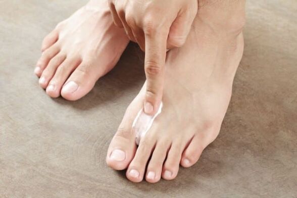 application of ointment from fungus on the skin of the feet